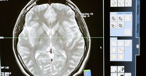 La deshidratación, un enemigo silencioso para la memoria y el rendimiento cerebral