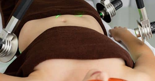 Woman getting fat loss procedure in clinic